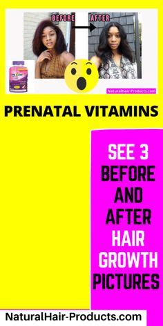 88 Best Vitamins for Black Hair Growth - NHP ideas | black hair growth ...