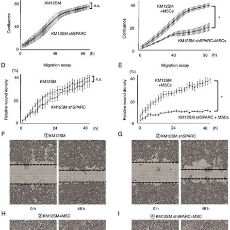 Expression levels and function of SPARC in CRC. (A) Gene expression ...