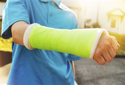 Broken Wrist | Common Causes and Treatment | OrthoIndy Blog