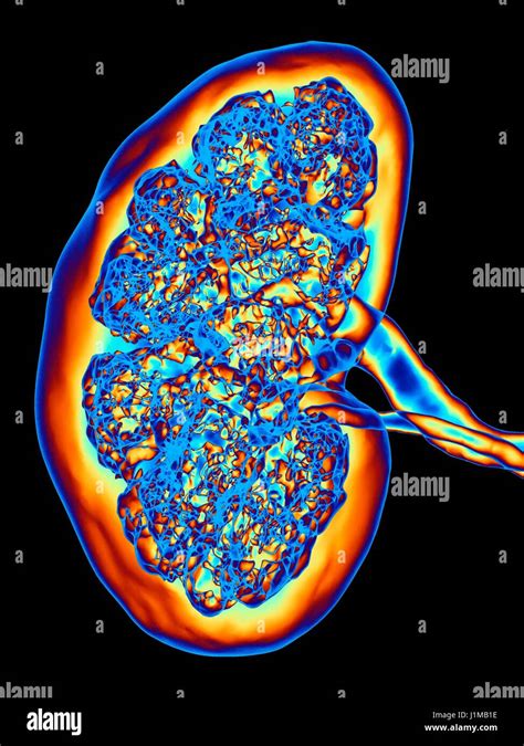 Kidney, CT scan. False colour 3-D computed tomography (CT) scan of a Stock Photo, Royalty Free ...