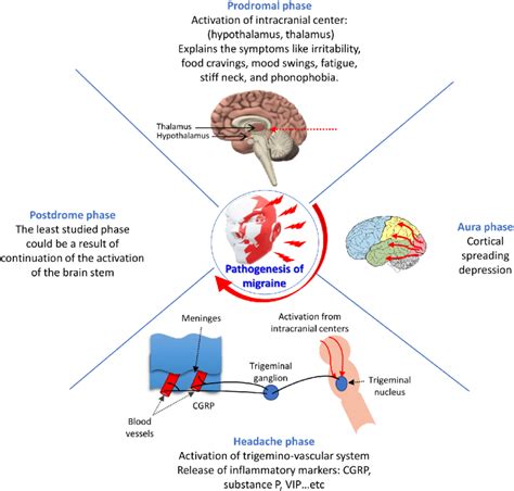 The mechanisms of the different phases of migraine. An overlap of the ...