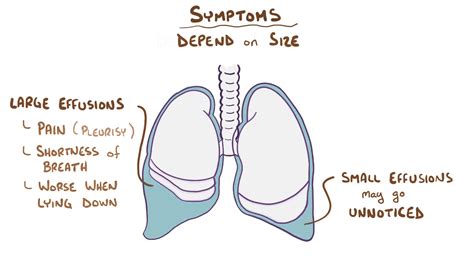 Pleural Effusion causes, symptoms, diagnosis, treatment, pathology - YouTube