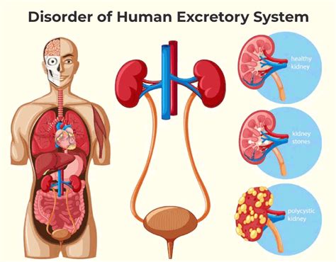 Excretory System Definition Diagram Organs And Function Excretory System Body Systems – Themeloader