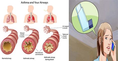 7 Ways To Survive An Asthma Attack If You're Caught Without An Inhaler - Daily Health Post