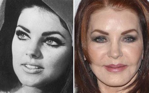 Priscilla Presley Plastic Surgery - See Image of her Botched Cheek Filler and Stretched Lips ...