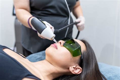 Soprano Ice Laser Hair Removal London 65% Off