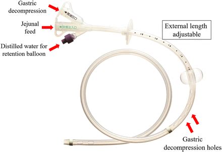 Percutaneous endoscopic transgastric jejunostomy (PEG-J): a retrospective analysis on its ...