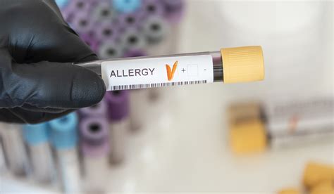 Allergen Testing - Cultivator Phyto Lab