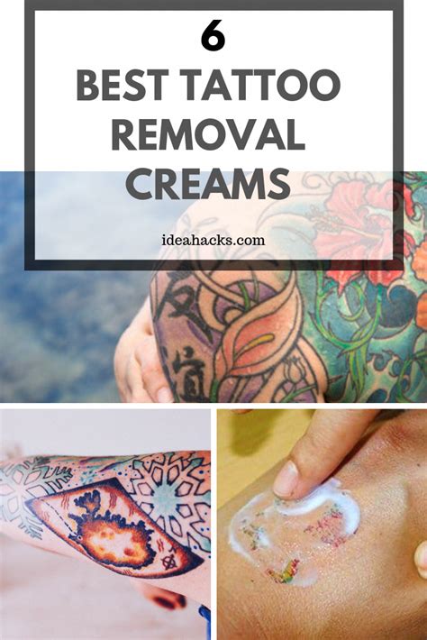 In the old days, tattoo removal hurt. Now we have tattoo removal creams, and they're easy to use ...