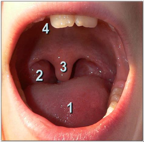 Fichier:LuettePalatineUvula.jpg — Wikipédia