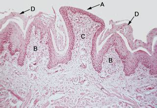 Oral Histology Digital Lab: Mucosa: Section of a Fungiform Papilla (Image 20)