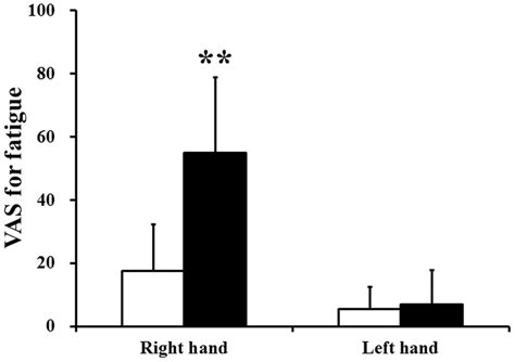 Visual analogue scale (VAS) values of right and left hands for fatigue... | Download Scientific ...