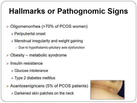 Polycystic Ovary Syndrome (PCOS) - 1290 Words | Presentation Example