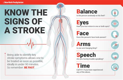 Know the signs of a Stroke | Retiree News