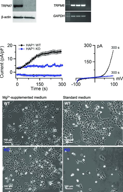 Functional characterization of endogenous TRPM7 currents in HAP1 cells... | Download Scientific ...