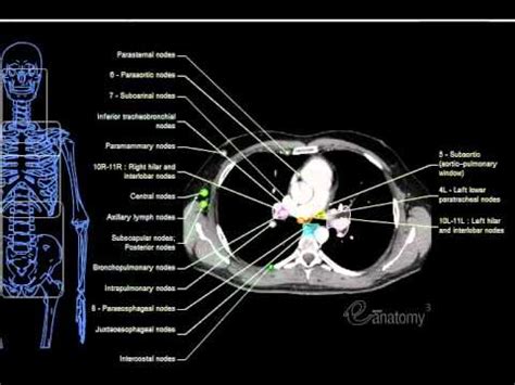 eAnatomy - Mediastinal Lymph Nodes (Hi Qual).mov - YouTube