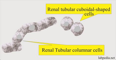 Urine Microscopic Examination, and Interpretations - Labpedia.net