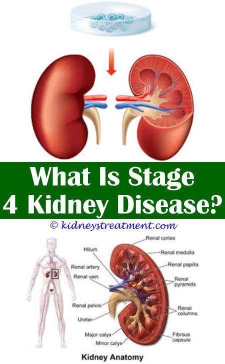 Stage 4 Diabetic Kidney Disease - DiabetesWalls