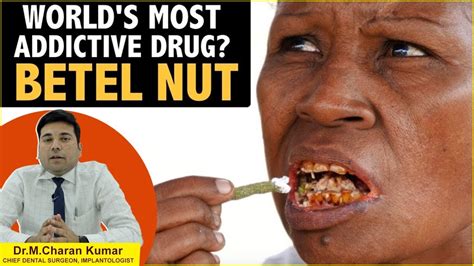 World's Most Addictive Drug | Adverse Health Effects Of Chewing Betel Nut | Eledent Dental ...