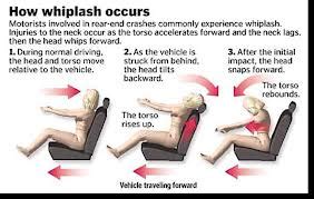 Whiplash ICBC Physiotherapy treatment Victoria