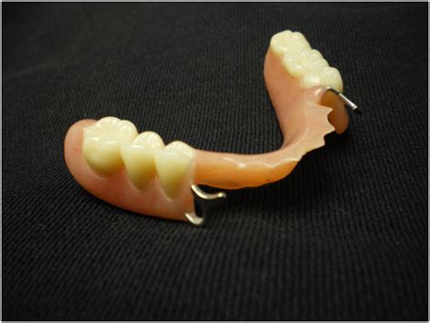 Owings Mills Partial Dentures Pikesville Partial Denture Towson