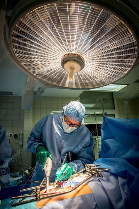 Cystectomy surgery - Stock Image - C034/3923 - Science Photo Library