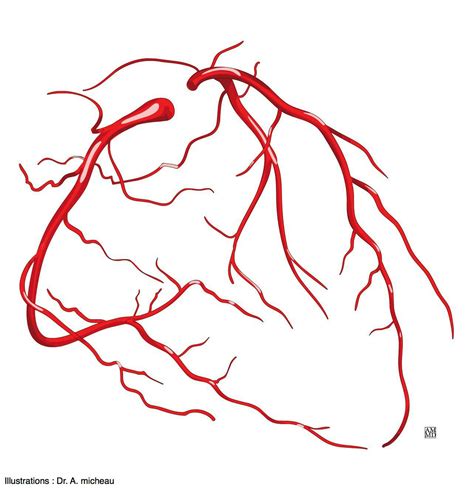 Proximal circumflex artery - e-Anatomy - IMAIOS