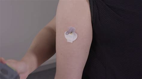 Medtronic™ Guardian™ Sensor 3 – Inserting Sensor into Upper Arm - YouTube