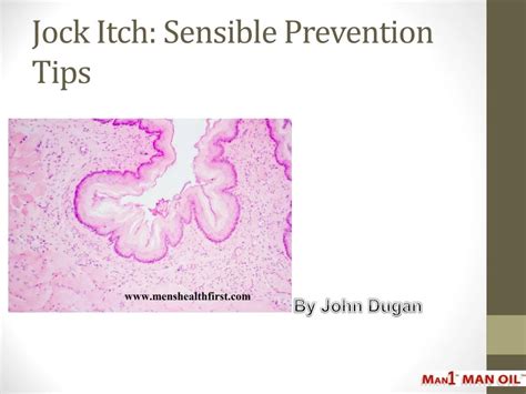 PPT - Jock Itch: Sensible Prevention Tips PowerPoint Presentation, free download - ID:7845691