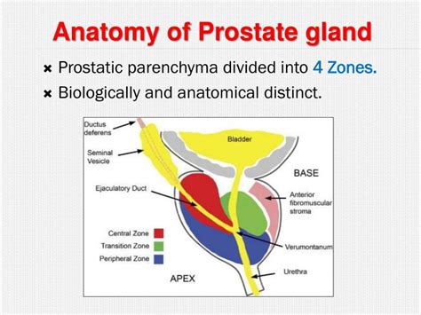 PPT - Benign prostatic Hyperplasia PowerPoint Presentation - ID:6703589