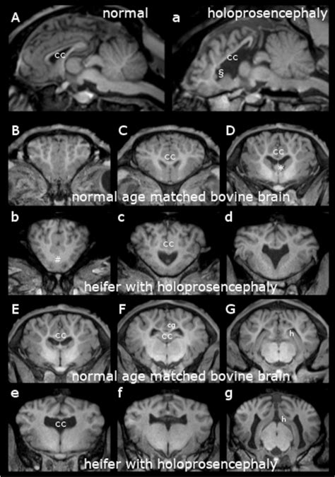 Magnetic resonance imaging (MRI) of a heifer with holoprosencephaly and ...