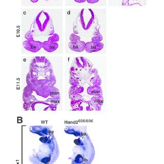 Branchial arch development in Hand2 EDE/EDE embryos. (A) Transverse... | Download Scientific Diagram