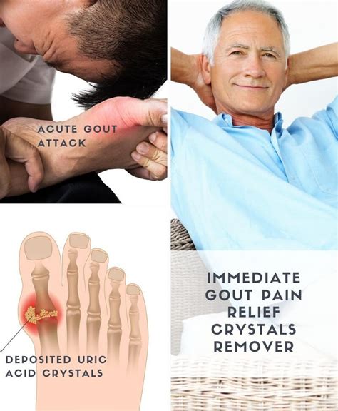 Immediate Gout Pain Relief & Crystals Removal Topical Treatment