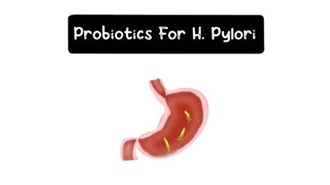 Can Probiotics Kill Helicobacter Pylori? - Probiotic Review Girl