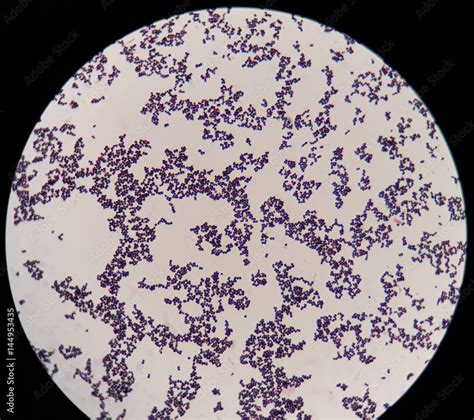 Smear of gram positive cocci bacteria under 100X light microscope ...