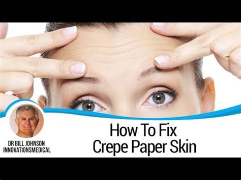 CREPE ERASE REVIEWS - How To Fix Crepe Paper Skin