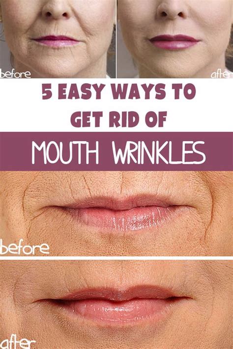 5 WAYS TO GET RID OF WRINKLES AROUND THE MOUTH | HEALTHYLIFE