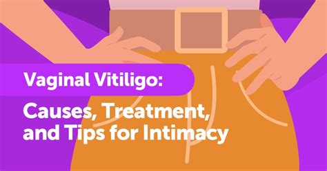 Vaginal Vitiligo: Causes, Treatment, and Tips for Intimacy | MyVitiligoTeam