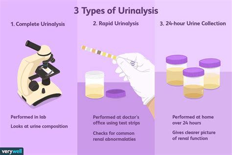 What Is The Best Time To Do A Urine Sample