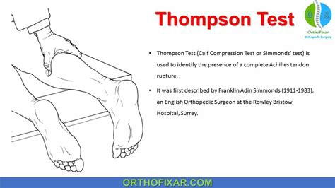 Thompson Test • Easy Explained | OrthoFixar 2024