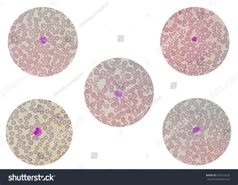 Blood Smear Under Microscope Present Neutrophil Stock Photo 603313220 ...