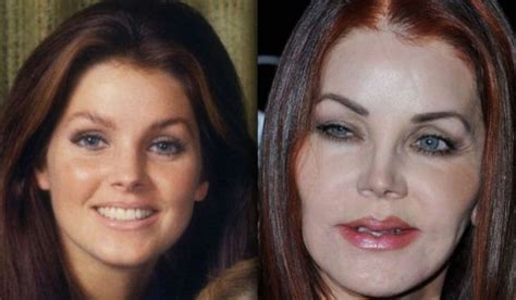 Priscilla Presley Plastic Surgery Went Horribly Wrong