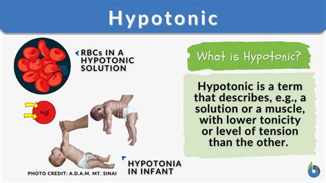 Hypotonic