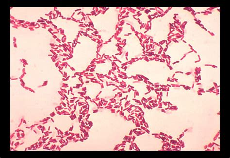 Public Domain Picture | Bacillus coagulans. Gram stain. | ID: 13528537213816 | PublicDomainFiles.com