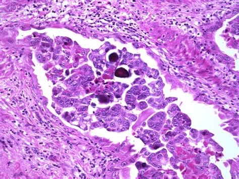 A Collection of Surgical Pathology Images | Biomedical science ...