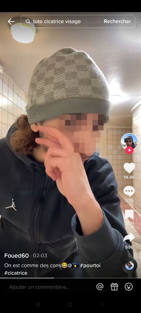 Cicatrice challenge : le nouveau défi dangereux sur TikTok