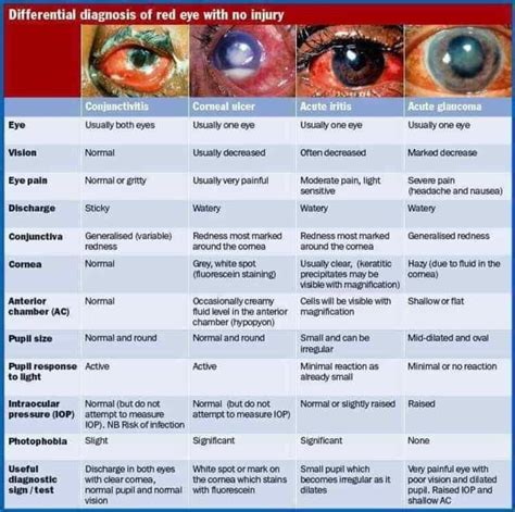 D.D. Of Red Eye: - Ophthalmology-Notes And Synopses