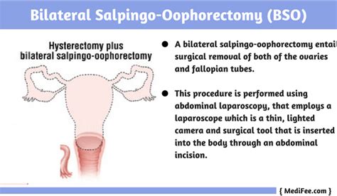 Ovarian Cancer Treatment: Surgery Procedure, Risks and Complications