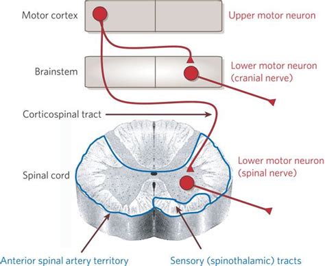 Lesions of Upper Motor Neurons and Lower Motor Neurons | MEDCHROME | Motor neuron, Neurons ...