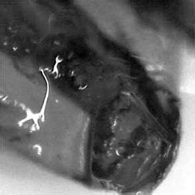 (A) Stereo microscope image of an apical delta with empty accessory... | Download Scientific Diagram